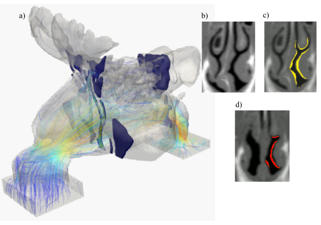 <p>Computergestützte fluiddynamische Simulation Dissertation Berger. ©Berger</p>